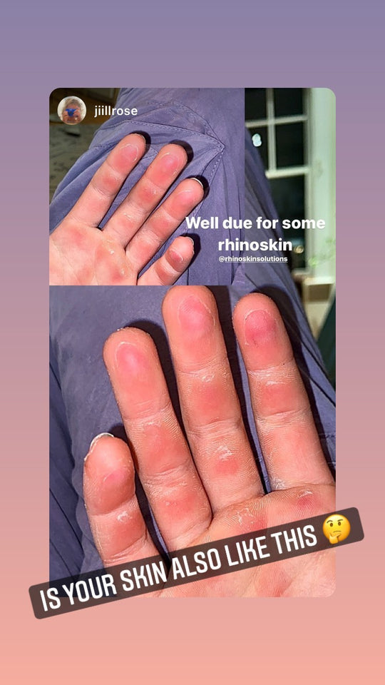 Before and after