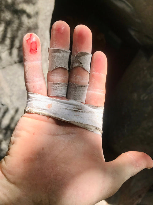 Climber caring for worn skin at the crag — Rhino blog skin tips.